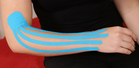 Lymphtaping
