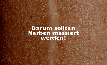 Darum sollten Narben massiert werden!