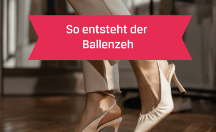 So entsteht der Ballenzeh